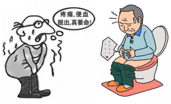 难言之疾二十载 技高器良一朝除